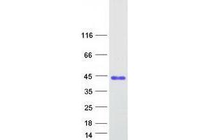 Validation with Western Blot