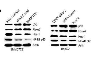 Effect of STAT1 on p53, Fbxw7, Hes-1 and NF-κB p65.