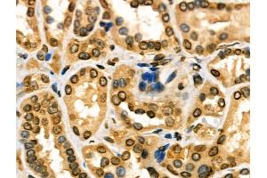 anti-Diacylglycerol Kinase, iota (DGKI) (C-Term) antibody