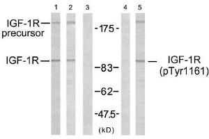 Western blot analysis using IGF-1R (Ab-1161) antibody (E021080, Line 1, 2 and 3) and IGF-1R (phospho-Tyr1161) antibody (E011087, Line 4 and 5). (IGF1R anticorps  (pTyr1161))