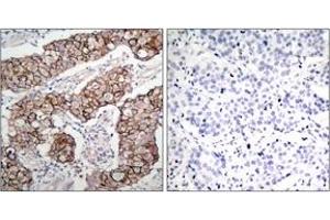 Immunohistochemistry (IHC) image for anti-Epidermal Growth Factor Receptor (EGFR) (pTyr1092) antibody (ABIN2888397) (EGFR anticorps  (pTyr1092))