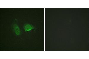 P-peptide - +Western blot analysis of extracts from LOVO cells, using Calcium Sensing Receptor (Phospho-Thr888) antibody. (CASR anticorps  (pThr888))