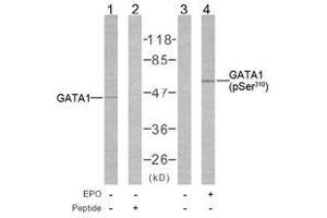 Image no. 1 for anti-GATA Binding Protein 1 (Globin Transcription Factor 1) (GATA1) (pSer310) antibody (ABIN2621191) (GATA1 anticorps  (pSer310))