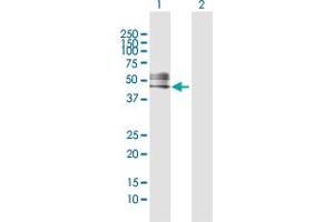 Western Blot analysis of RTN4R expression in transfected 293T cell line by RTN4R MaxPab polyclonal antibody. (RTN4R anticorps  (AA 1-473))