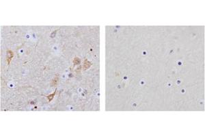 Immunohistochemistry analysis of human brain tissue slide (Paraffin embedded) using Rabbit Anti-NSE Polyclonal Antibody (Left, ABIN398881) and Purified Rabbit IgG (Whole molecule) Control (Right, ABIN398653) (ENO2/NSE anticorps  (C-Term))