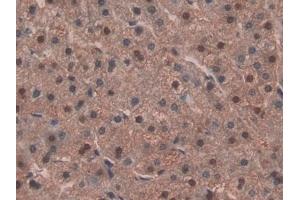 Detection of IDH1 in Human Liver Tissue using Polyclonal Antibody to Isocitrate Dehydrogenase 1, Soluble (IDH1) (IDH1 anticorps  (AA 74-333))