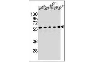 Western blot analysis of PAX1 Antibody (C-term) in HepG2, MDA-MB453, 293, K562, MCF-7 cell line lysates (35ug/lane). (PAX1 anticorps  (C-Term))