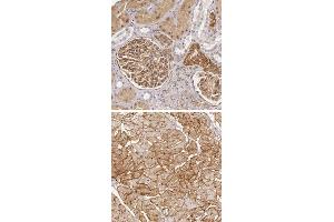 Immunohistochemical staining of human heart muscle with LAMB2 polyclonal antibody  shows distinct membranous positivity in myocytes. (LAMB2 anticorps)