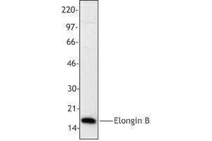 Western Blotting (WB) image for anti-Transcription Elongation Factor B (SIII), Polypeptide 2 (18kDa, Elongin B) (TCEB2) antibody (ABIN2666332) (TCEB2 anticorps)