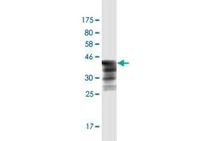 Western Blot detection against Immunogen (44. (HSPB7 anticorps  (AA 1-170))