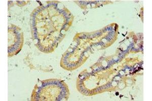 Immunohistochemistry of paraffin-embedded human small intestine tissue using ABIN7153890 at dilution of 1:100