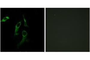 Immunofluorescence analysis of HepG2/HeLa cells, using HARS Antibody. (HARS1/Jo-1 anticorps  (AA 460-509))