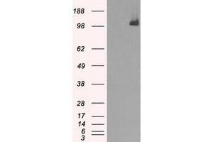 Image no. 5 for anti-Budding Uninhibited By Benzimidazoles 1 Homolog beta (Yeast) (BUB1B) antibody (ABIN1496995) (BUB1B anticorps)