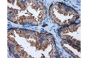 Immunohistochemical staining of paraffin-embedded Kidney tissue using anti-RALBP1 mouse monoclonal antibody.
