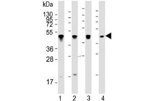 Western blot testing of human 1) NCI-H460, 2) K562, 3) Hela and 4) A431 whole cell lysate with Cytokeratin-18 antibody at 1:2000.