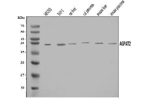 Western blot analysis of AGPAT2 using anti-AGPAT2 antibody (ABIN7602435).