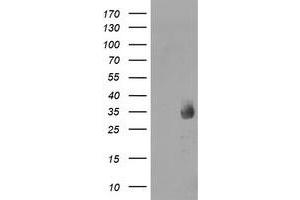 Western Blotting (WB) image for anti-Methylmalonic Aciduria (Cobalamin Deficiency) CblC Type, with Homocystinuria (MMACHC) antibody (ABIN1499512) (MMACHC anticorps)