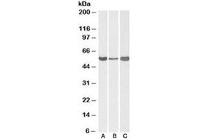 Western blot testing of human [A] and mouse [B] liver, and rat [C] testis lysate with ALDH1A1 antibody at 0. (ALDH1A1 anticorps)