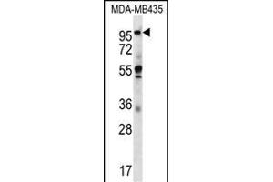 CTAGE5 Antibody (C-term) (ABIN656676 and ABIN2845915) western blot analysis in MDA-M cell line lysates (35 μg/lane). (MIA2 anticorps  (C-Term))