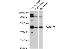 Western blot analysis of extracts of various cell lines, using B4G antibody (ABIN7271199) at 1:1000 dilution. (B4GALT3 anticorps  (AA 40-150))