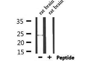 Western blot analysis of extracts from rat brain, using ZNRF1 Antibody. (ZNRF1 anticorps  (Internal Region))