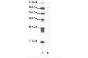 Image no. 1 for anti-Aspartate beta-Hydroxylase (ASPH) (AA 312-361) antibody (ABIN202902) (Aspartate beta Hydroxylase anticorps  (AA 312-361))