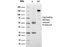SDS-PAGE Analysis Purified TYRP1-Monospecific Mouse Monoclonal Antibody (TYRP1/3280).