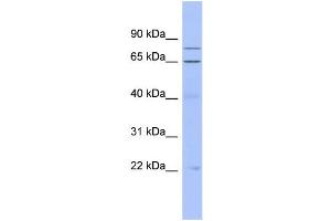 WB Suggested Anti-ZNF431 Antibody Titration:  0. (ZNF431 anticorps  (Middle Region))
