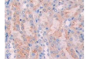 Detection of CA7 in Mouse Kidney Tissue using Polyclonal Antibody to Carbonic Anhydrase VII (CA7)