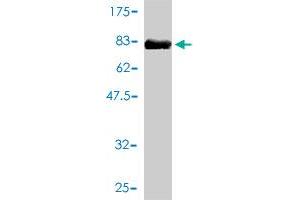 Western Blot detection against Immunogen (72. (IL11RA anticorps  (AA 1-422))