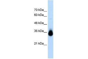 WB Suggested Anti-HOXC9 Antibody Titration:  2. (HOXC9 anticorps  (N-Term))
