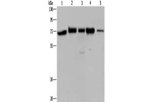 Gel: 8 % SDS-PAGE, Lysate: 40 μg, Lane 1-5: A172 cells, Hela cells, 293T cells, K562 cells, human testis tissue, Primary antibody: ABIN7128290(AGFG1 Antibody) at dilution 1/727, Secondary antibody: Goat anti rabbit IgG at 1/8000 dilution, Exposure time: 40 seconds (AGFG1 anticorps)