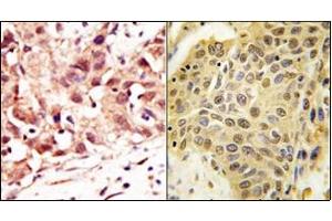 Image no. 2 for anti-SUMO1/sentrin Specific Peptidase 5 (SENP5) (C-Term) antibody (ABIN356757) (SENP5 anticorps  (C-Term))