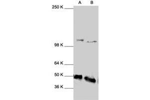 Western Blot analysis of NFKB1 polyclonal antibody  expression in HeLa (A) and HL-60 (B) whole cell lysates. (NFKB1 anticorps  (C-Term))