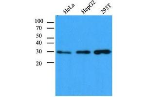 The cell lysates (40 ug) were resolved by SDS-PAGE, transferred to PVDF membrane and probed with anti-human CBR1 antibody (1:1,000). (CBR1 anticorps  (AA 1-277))