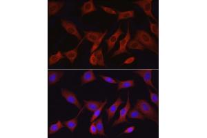 Immunofluorescence analysis of NIH/3T3 cells using T Rabbit pAb (ABIN6130537, ABIN6143503, ABIN6143504 and ABIN6215581) at dilution of 1:50 (40x lens).