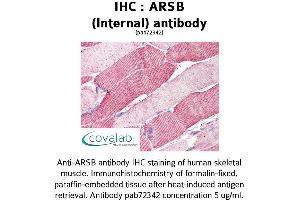Image no. 1 for anti-Arylsulfatase B (ARSB) (Internal Region) antibody (ABIN1731968) (Arylsulfatase B anticorps  (Internal Region))