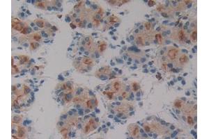 DAB staining on IHC-P; Samples: Human Stomach Tissue