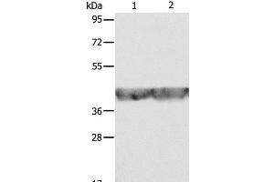 Western Blot analysis of A549 and hela cell using ALDOA Polyclonal Antibody at dilution of 1:500 (ALDOA anticorps)