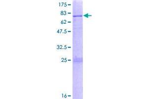 Image no. 1 for Small Nuclear RNA Activating Complex, Polypeptide 1, 43kDa (SNAPC1) (AA 1-368) protein (GST tag) (ABIN1320759)