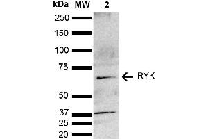 Western blot analysis of Mouse brain lysate showing detection of ~67. (RYK anticorps  (AA 150-250) (Biotin))