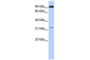 Image no. 1 for anti-Glutamate Receptor, Metabotropic 6 (GRM6) (AA 36-85) antibody (ABIN6741410)