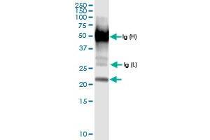 Immunoprecipitation of GLO1 transfected lysate using anti-GLO1 MaxPab rabbit polyclonal antibody and Protein A Magnetic Bead , and immunoblotted with GLO1 MaxPab rabbit polyclonal antibody (D01) . (GLO1 anticorps  (AA 1-184))