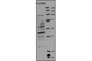 Western blot analysis of anti-RFC5 Antibody (Center ) (ABIN389314 and ABIN2839435) in rat SMC cell line lysates (35 μg/lane). (RFC5 anticorps  (AA 170-200))