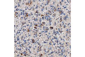 IHC analysis of RAB7/RAB7A using anti-RAB7/RAB7A antibody (ABIN7600597). (RAB7A anticorps  (AA 21-177))