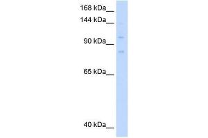 MCM8 antibody used at 0. (MCM8 anticorps  (C-Term))