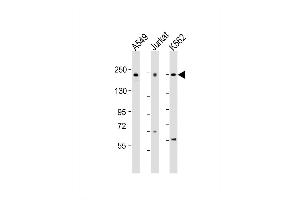 Western Blot at 1:2000 dilution Lane 1: A549 whole cell lysate Lane 2: Jurkat whole cell lysate Lane 3: K562 whole cell lysate Lysates/proteins at 20 ug per lane. (PSME4 anticorps  (AA 503-535))