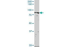 FLI1 monoclonal antibody (M02), clone 2G8. (FLI1 anticorps  (AA 1-452))