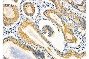 anti-Cytochrome C Oxidase Assembly Homolog 19 (COX19) (N-Term) antibody