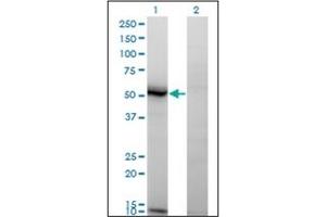 Western Blotting (WB) image for anti-N-Acylsphingosine Amidohydrolase (Acid Ceramidase) 1 (ASAH1) (AA 25-125) antibody (ABIN782337)
